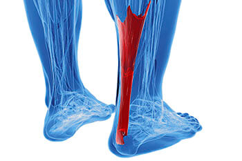 Achilles tendonitis treatment in the Las Vegas, NV 89128 area