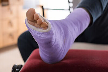 Foot Fractures treatment in the Clark County, NV: Las Vegas (North Las Vegas, Spring Valley, Sunrise Manor, Paradise, Enterprise, Henderson, Whitney, Winchester, Summerlin South) areas