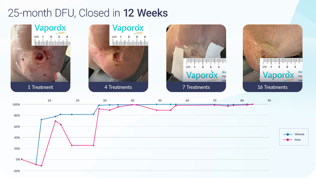 Vaporox 12 Weeks