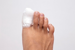 Has My Child Broken a Toe?