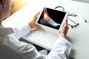 Open Reduction and Internal Fixation Surgery for Broken Ankles