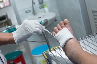 Different Types of Diabetic Foot Ulcers