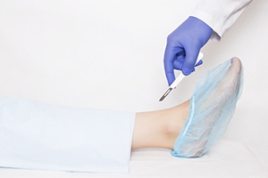 Facts About Ankle Replacement