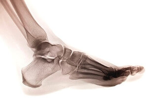 When Should I See A Doctor For My Toe Injury?