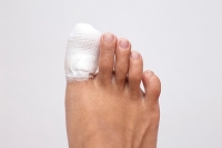 All About Broken Toes