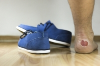 Reasons Blisters Develop on the Feet