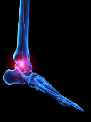 Toe Arthritis Can Be Painful